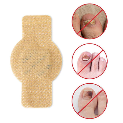 Onychomycosis stickers